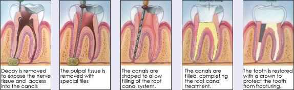 procedure